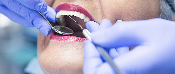 Best Emergency Tooth Extraction in Terrell Hills, TX